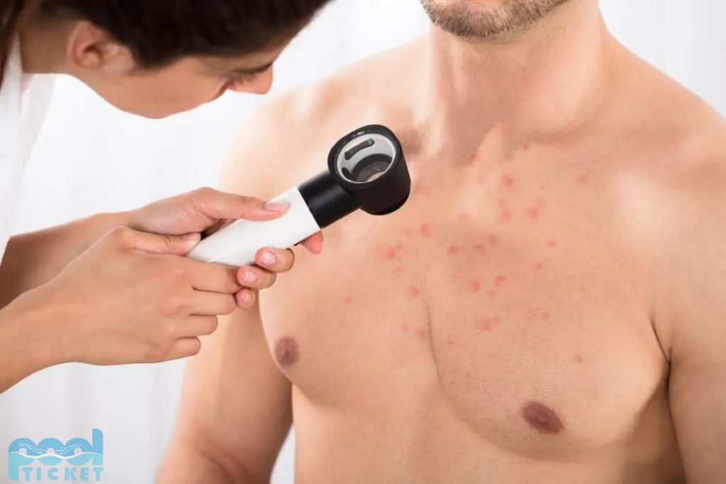How to get rid of chest acne 4